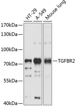 TGF beta Receptor 2 antibody