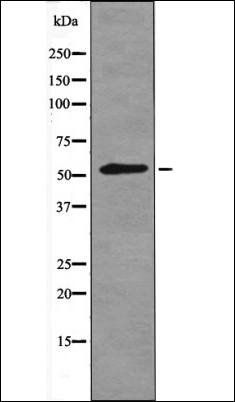 Phospho-TGFBR1 (Ser165) Antibody