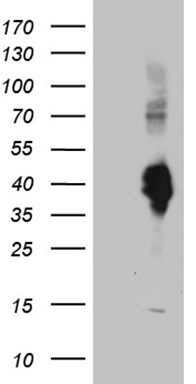 TGFBR3 Antibody