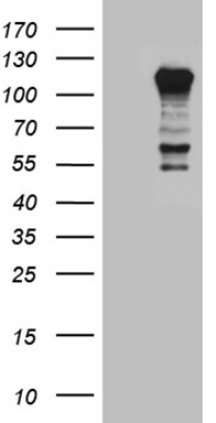 TGFBR3 Antibody