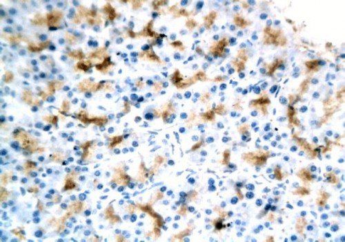 TGF beta 1 antibody