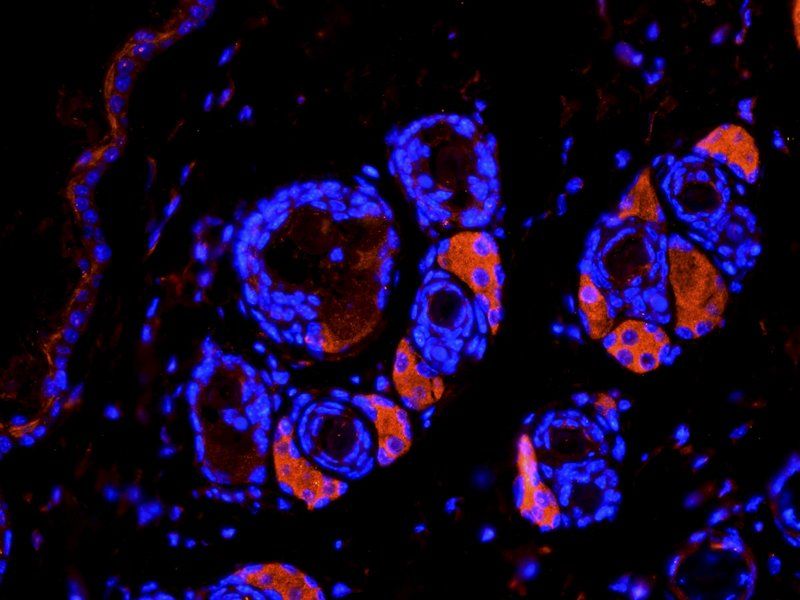 TGF beta 1 antibody