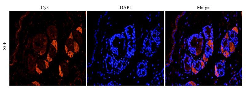 TGF beta 1 antibody