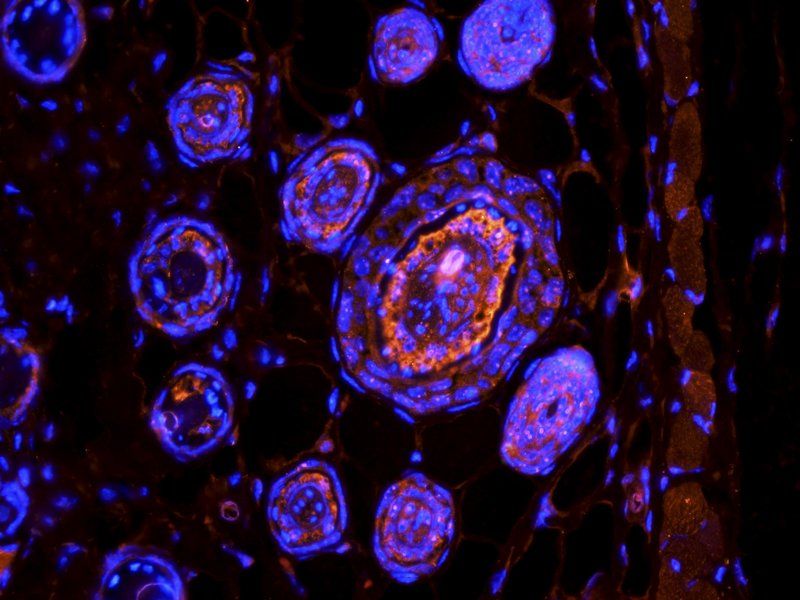 TGF beta 1 antibody