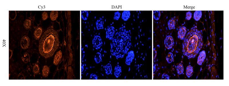 TGF beta 1 antibody