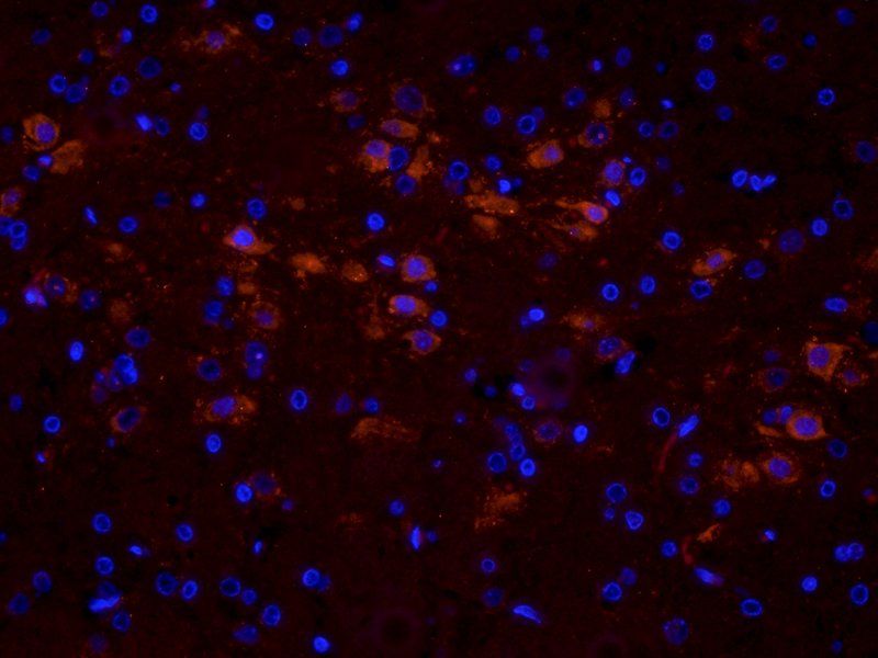 TGF beta 1 antibody