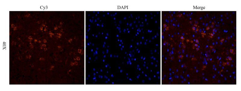 TGF beta 1 antibody