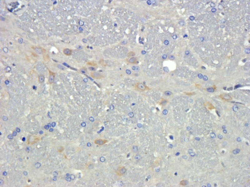 TGF beta 1 antibody