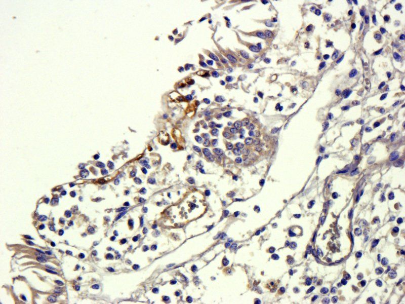 TGF beta 1 antibody