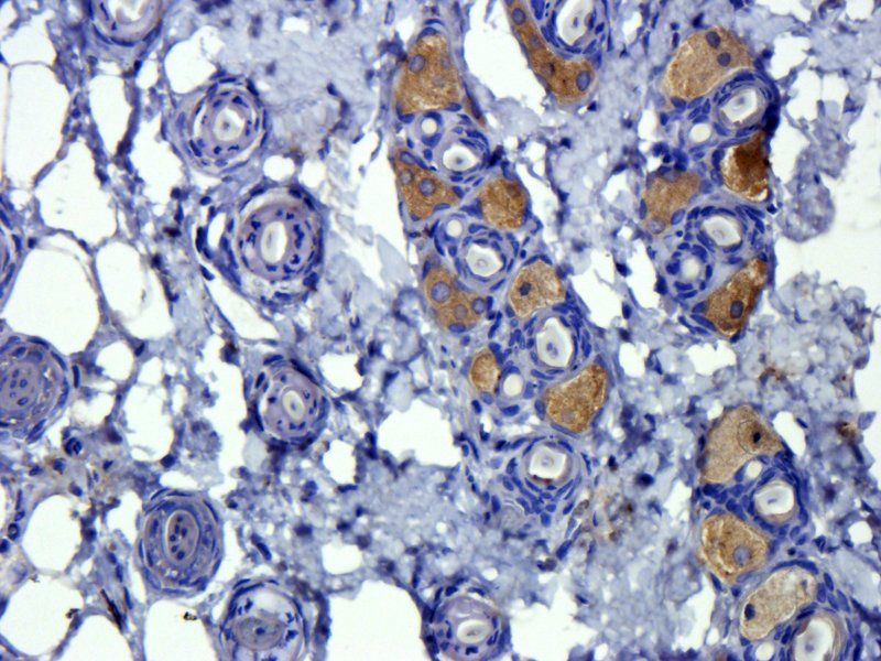 TGF beta 1 antibody