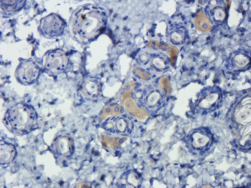 TGF beta 1 antibody