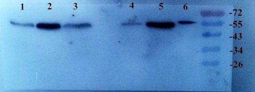 TGF beta 1 antibody