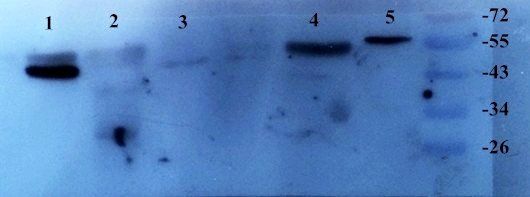 TGF beta 1 antibody