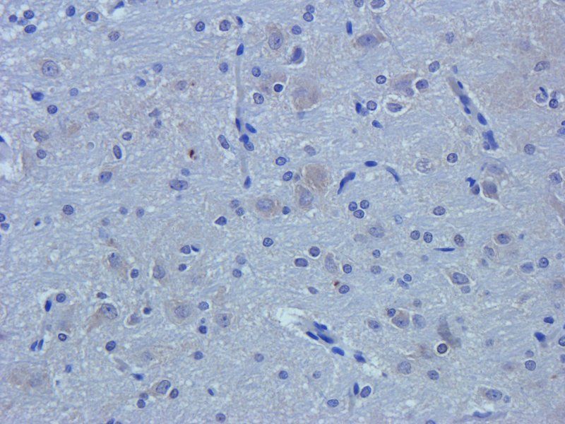 TGF beta Receptor 2 antibody