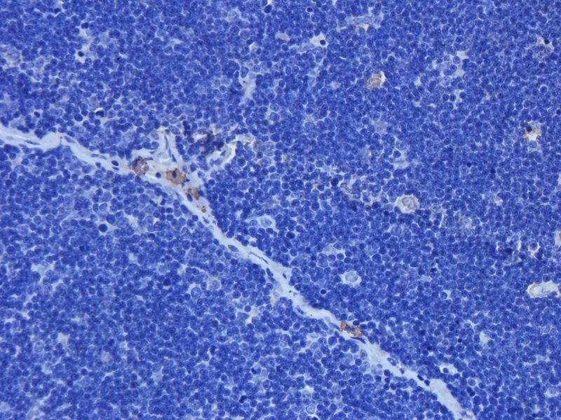 TGF beta Receptor 2 antibody