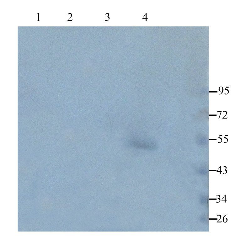 TGF beta Receptor 2 antibody