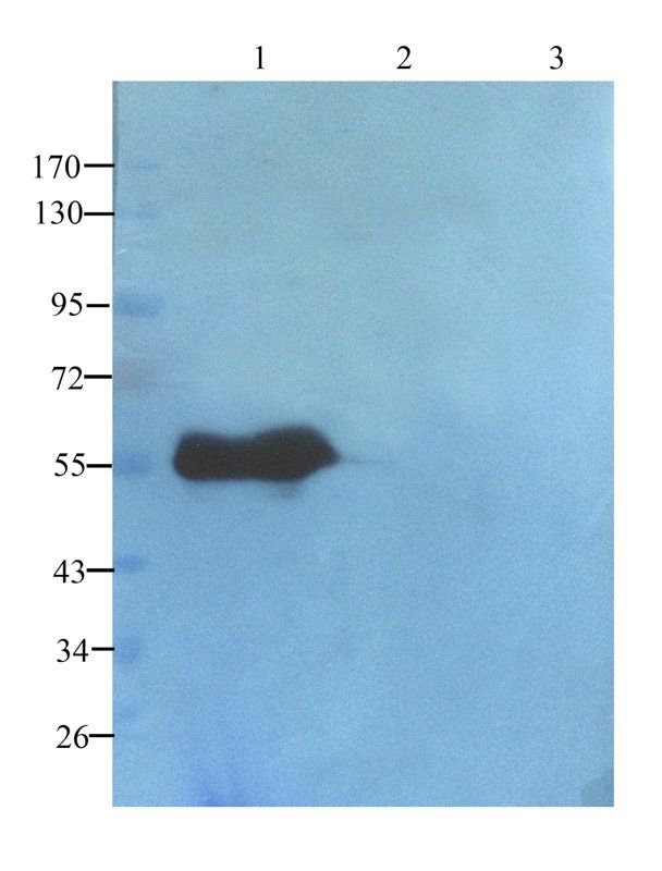 TGF beta Receptor 2 antibody