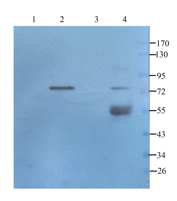 TGF beta Receptor 2 antibody