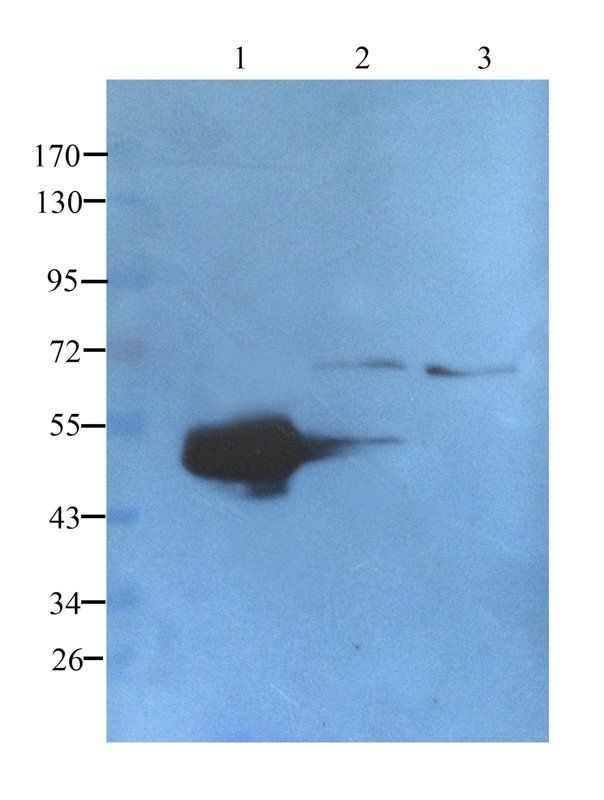 TGF beta Receptor 2 antibody