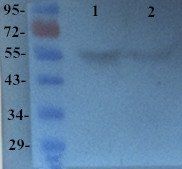 TGF beta Receptor 2 Rabbit Polyclonal Antibody