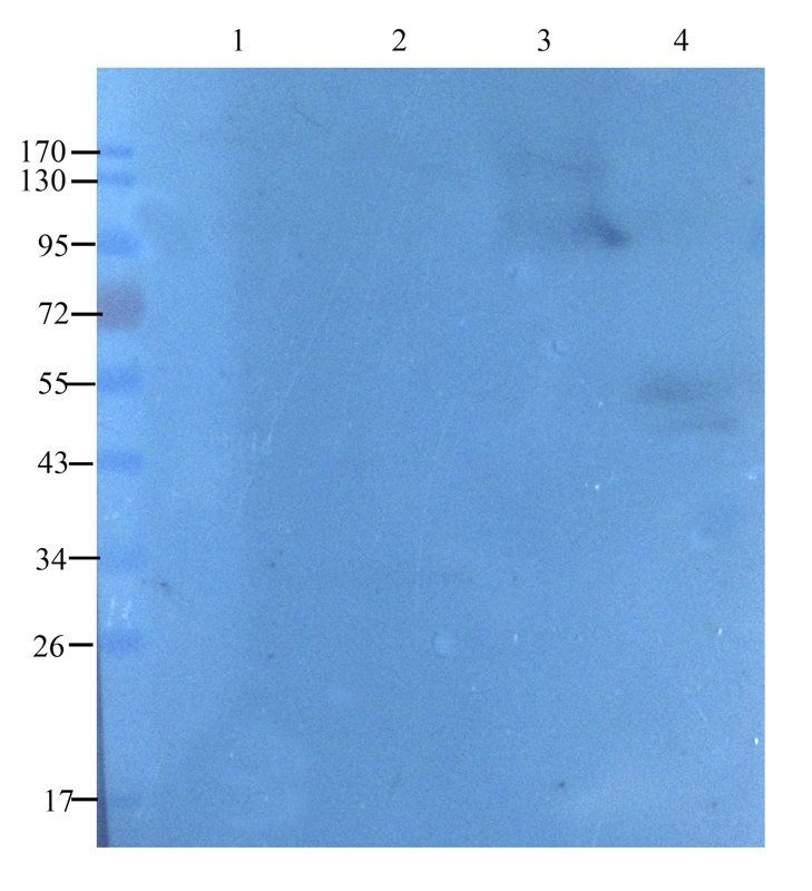 TGF beta Receptor 2 antibody