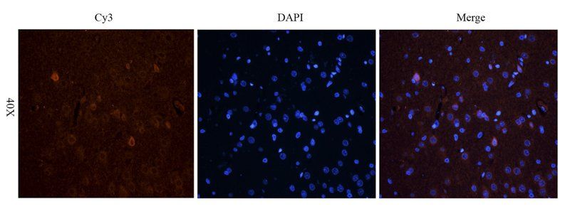 TGF beta Receptor 2 antibody