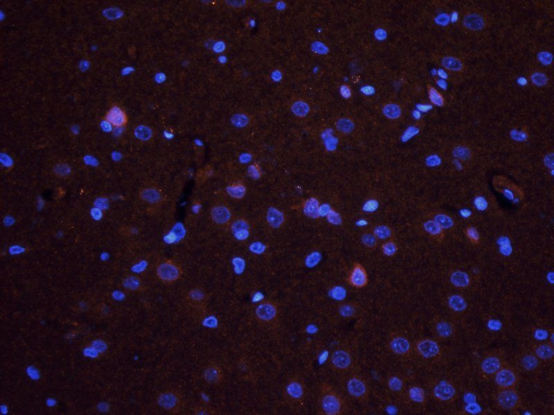 TGF beta Receptor 2 antibody