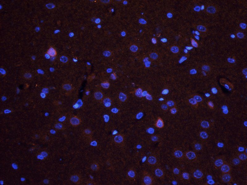 TGF beta Receptor 2 antibody