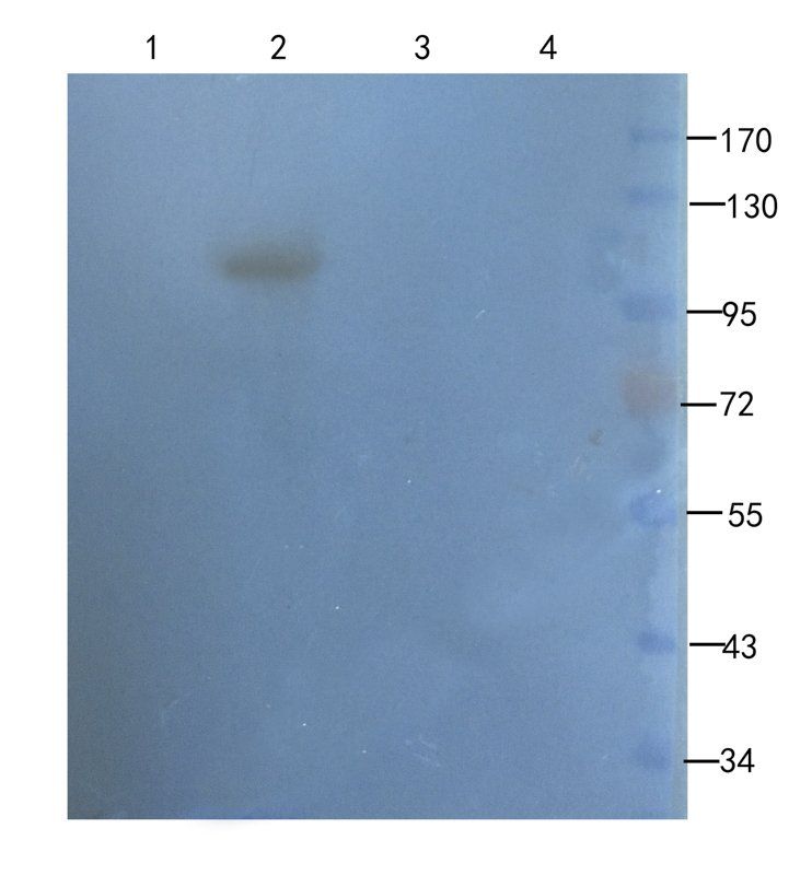 TGF beta Receptor 2 antibody