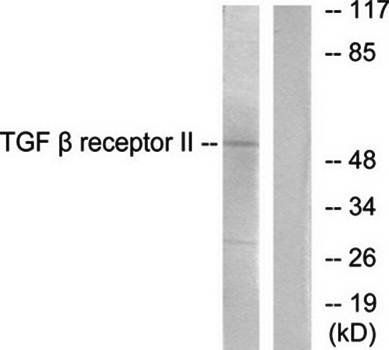 TGF β Receptor II Antibody