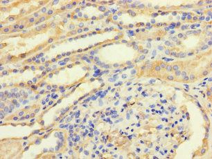 TGFB3 antibody