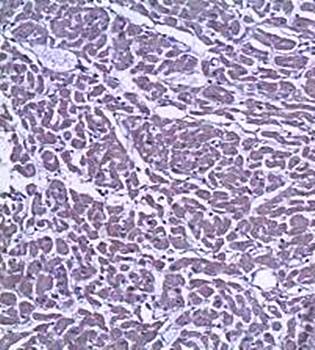 TGF beta 1 Rabbit Polyclonal Antibody