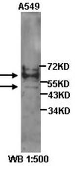 TGF beta 1 Rabbit Polyclonal Antibody