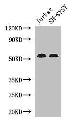 TGFBR1 antibody