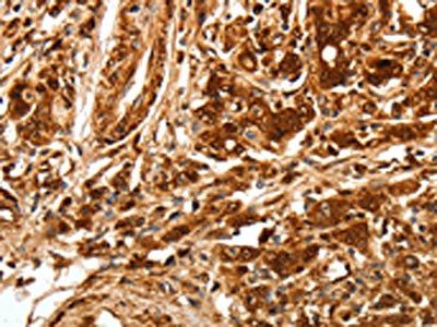 TGFBR1 Antibody