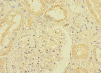 TGFBR3 Antibody