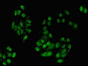 TGIF2 Antibody