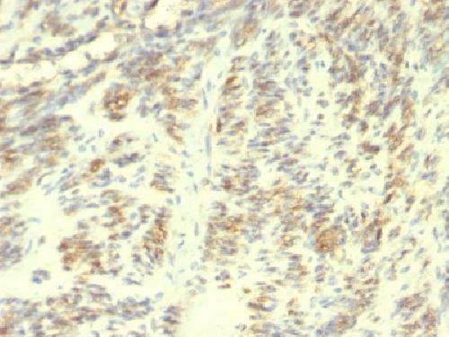 Transglutaminase II (TGM2) Antibody