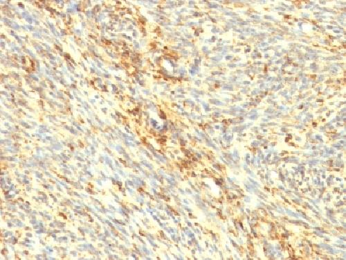 Transglutaminase II (TGM2) Antibody