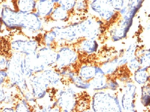 Transglutaminase II (TGM2) Antibody