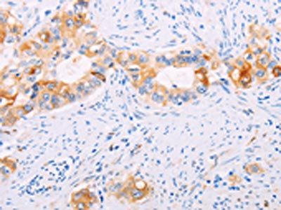 TGM2 Antibody