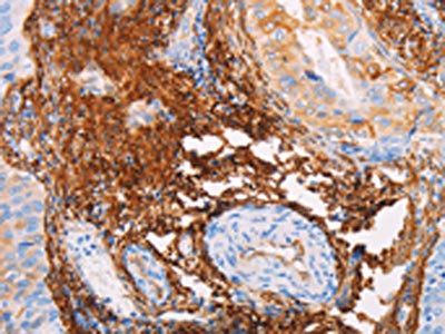 TGM2 Antibody