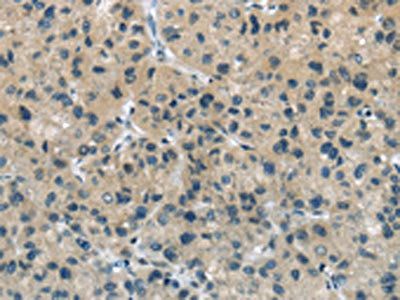 TGM5 Antibody