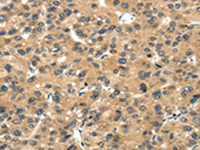 TGM5 Antibody