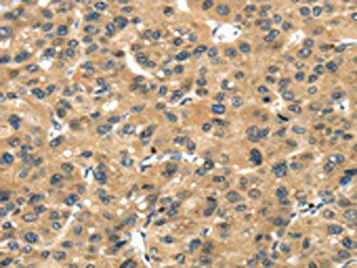 TGM5 antibody