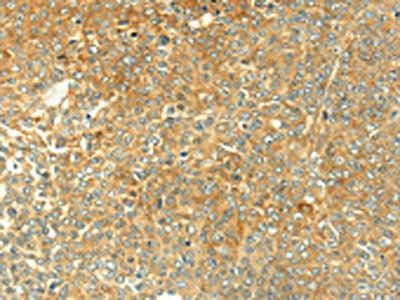TGM5 Antibody