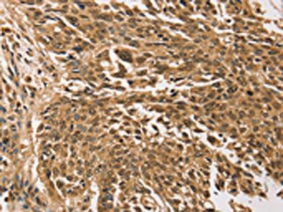 TGM7 Antibody