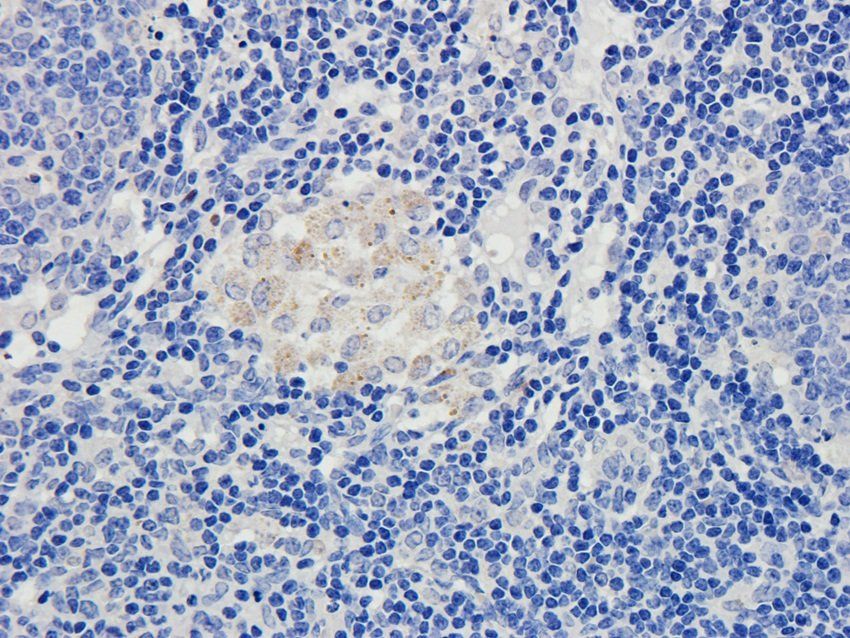 TGN46 antibody