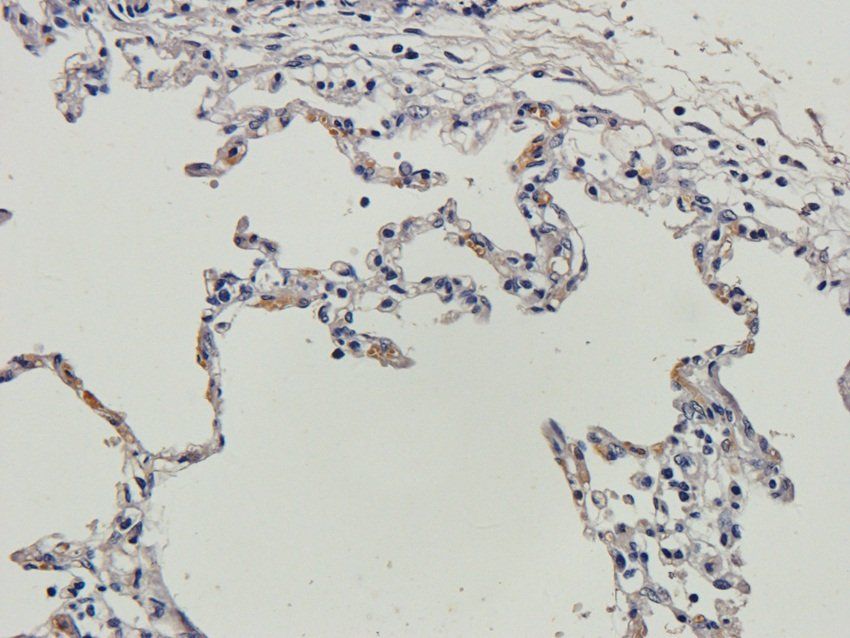 TGN46 antibody