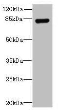 TGS1 antibody